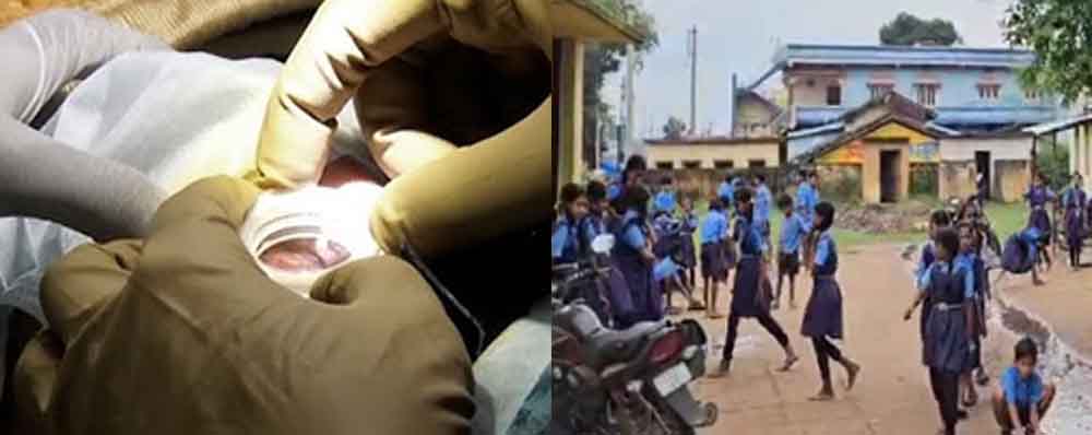 छत्तीसगढ़-जगदलपुर में खेलते समय छात्रा के भाई ने आंख में घुसेड़ दी स्प्रिंग, डॉक्टरों ने दी नई जिंदगी छत्तीसगढ़-जगदलपुर में खेलते समय छात्रा के भाई ने आंख में घुसेड़ दी स्प्रिंग, डॉक्टरों ने दी नई जिंदगी