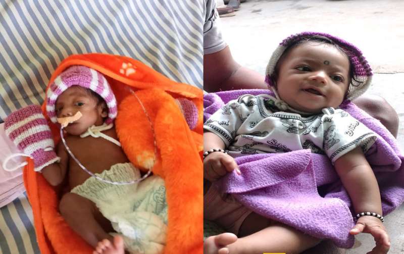 गरीब परिवार की नवजात पलक को मिला नया जीवन गरीब परिवार की नवजात पलक को मिला नया जीवन