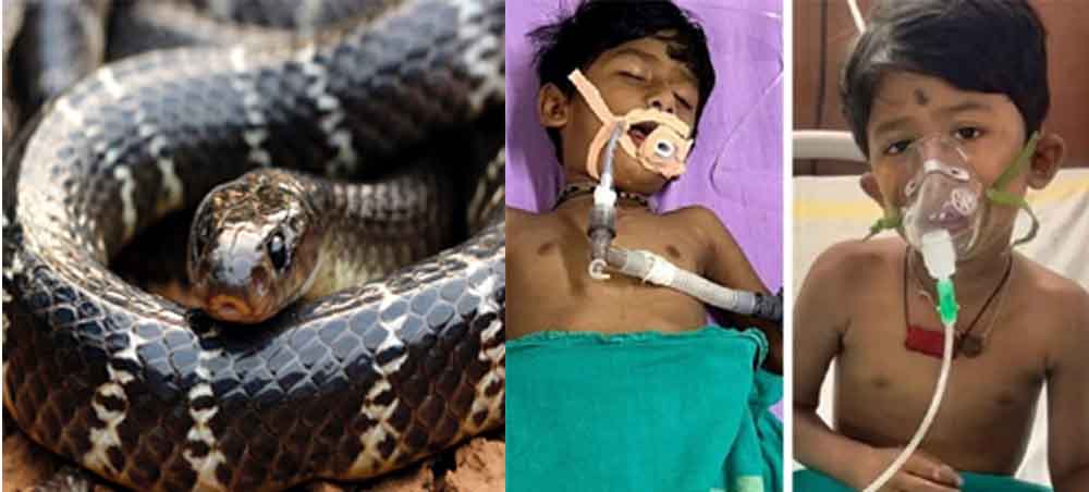 छत्तीसगढ़-रायगढ़ में करैत के डसने से मरणासन्न हुआ मानविक, डॉक्टरों ने बचाई जान