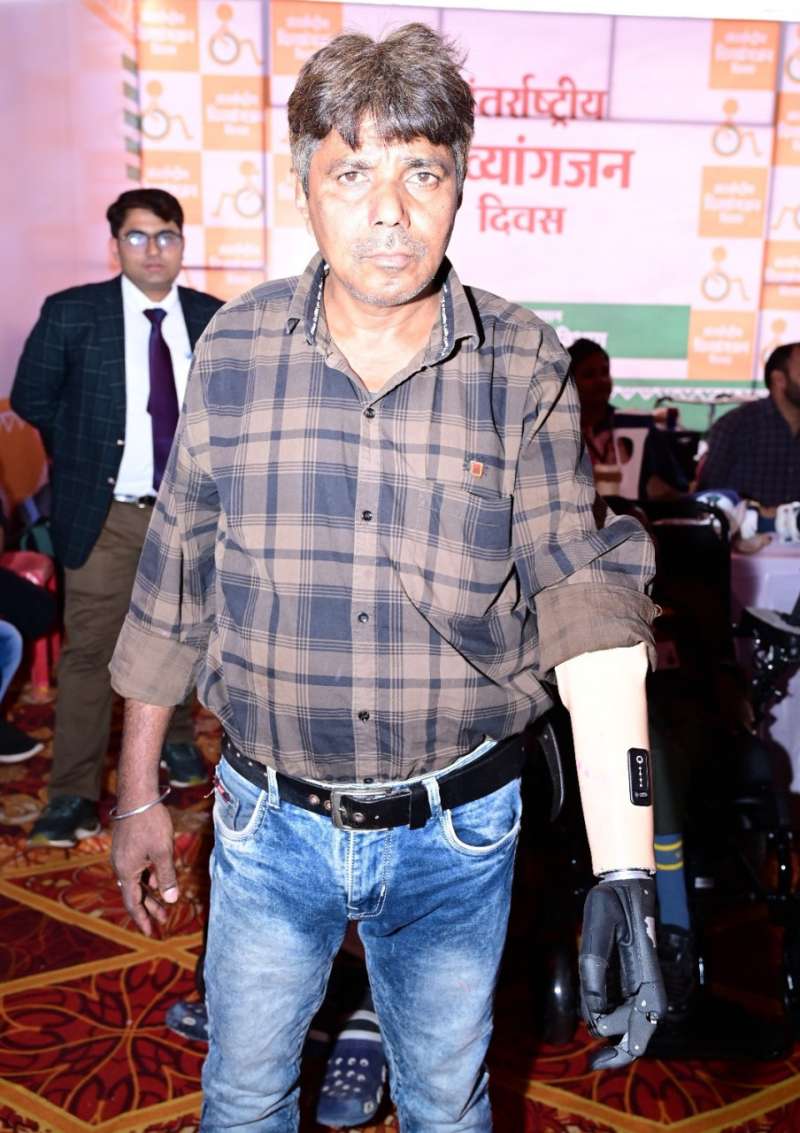 मोहन को जब मिला निःशुल्क कृत्रिम फंक्शनबेल हाथ, तो खिल उठा चेहरा, बोले अब सब कार्य स्वंय कर सकूंगा मोहन को जब मिला निःशुल्क कृत्रिम फंक्शनबेल हाथ, तो खिल उठा चेहरा, बोले अब सब कार्य स्वंय कर सकूंगा