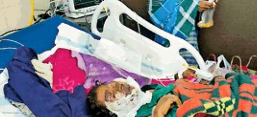 10 साल की बच्ची आइईडी ब्लास्ट में घायल 10 साल की बच्ची आइईडी ब्लास्ट में घायल