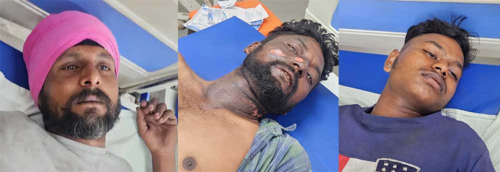 खेत में बड़ा हादसा: हार्वेस्टर चालक समेत तीन लोग 11kV तार की चपेट में आने से बुरी तरह झुलसे