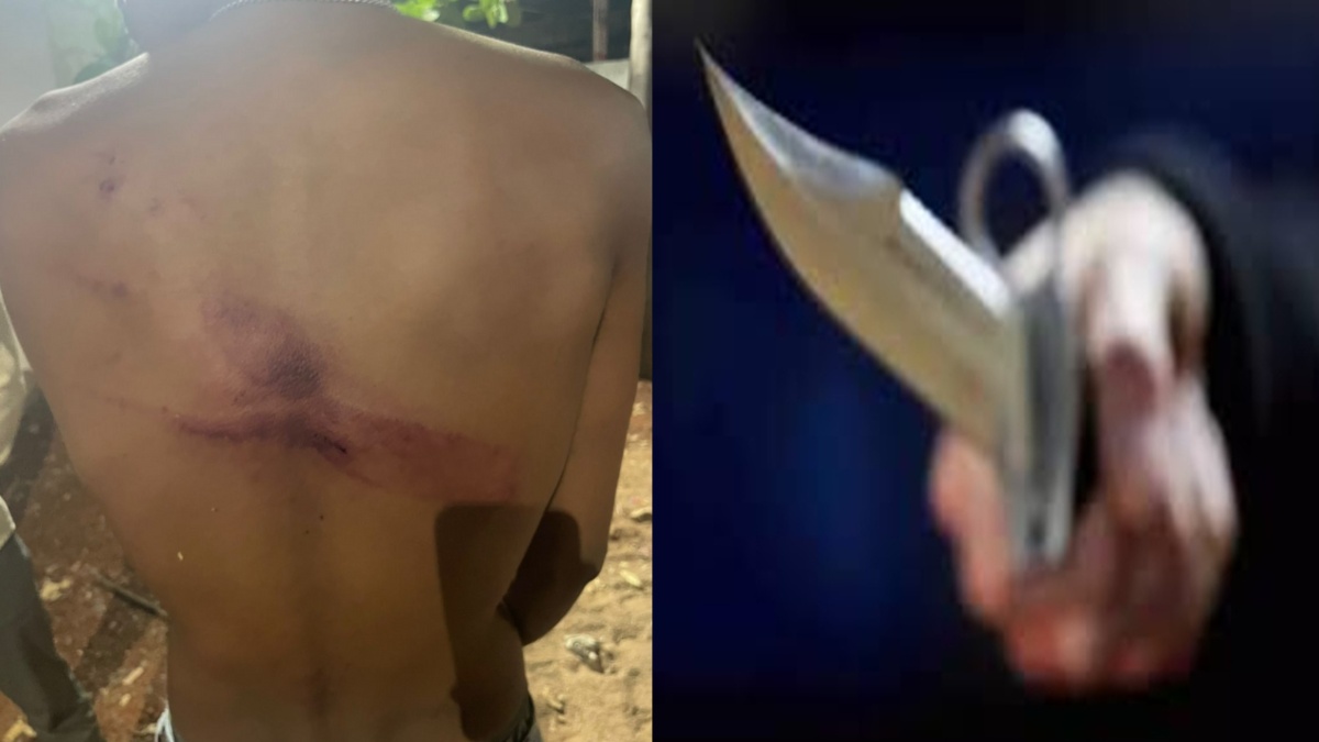 CG Crime- राजधानी में बेखौफ अपराधियों का कहर : ऑटो चालक से चाकू की नोक पर लूट, विरोध करने पर की बेरहमी से पिटाई….