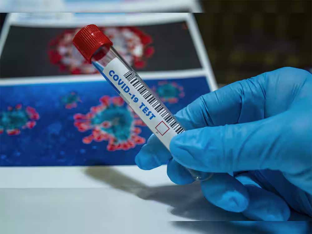 रायपुर से कोरोना को लेकर राहत की खबर आई सामने, 10 मरीज हुए ठीक रायपुर से कोरोना को लेकर राहत की खबर आई सामने, 10 मरीज हुए ठीक