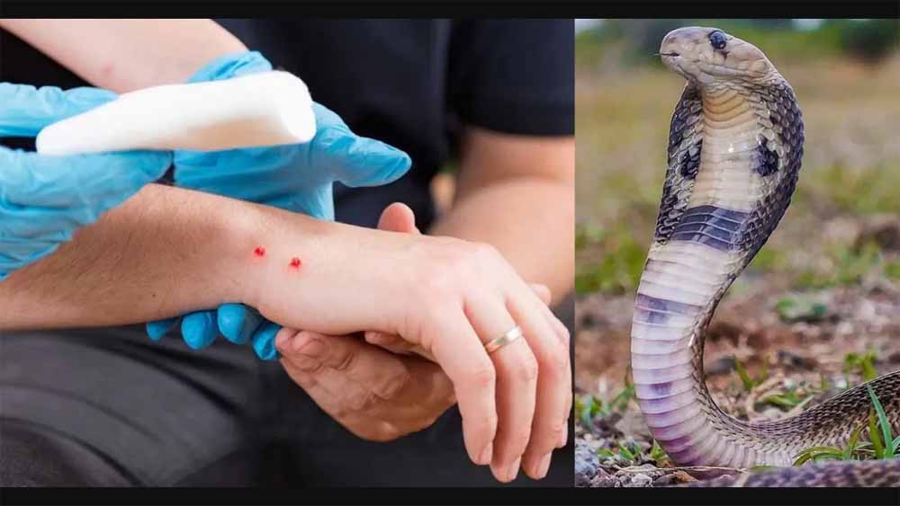 सांप काटने पर सीधे पहुंचे अस्पताल स्वास्थ्य विभाग ने जारी की एडवायजरी सांप काटने पर सीधे पहुंचे अस्पताल स्वास्थ्य विभाग ने जारी की एडवायजरी